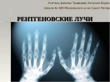 Использование рентгенографии для изучения спортивных травм